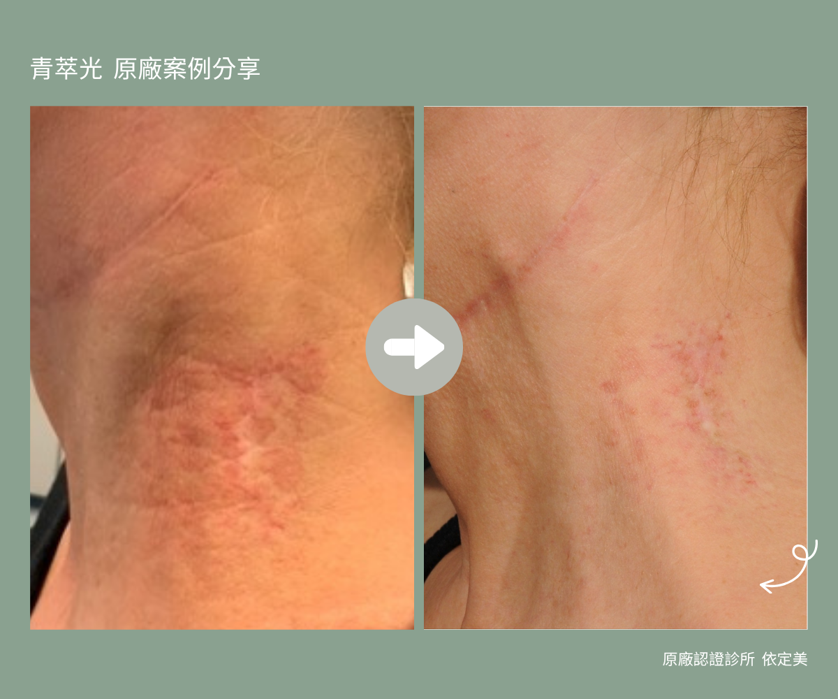 青萃光12