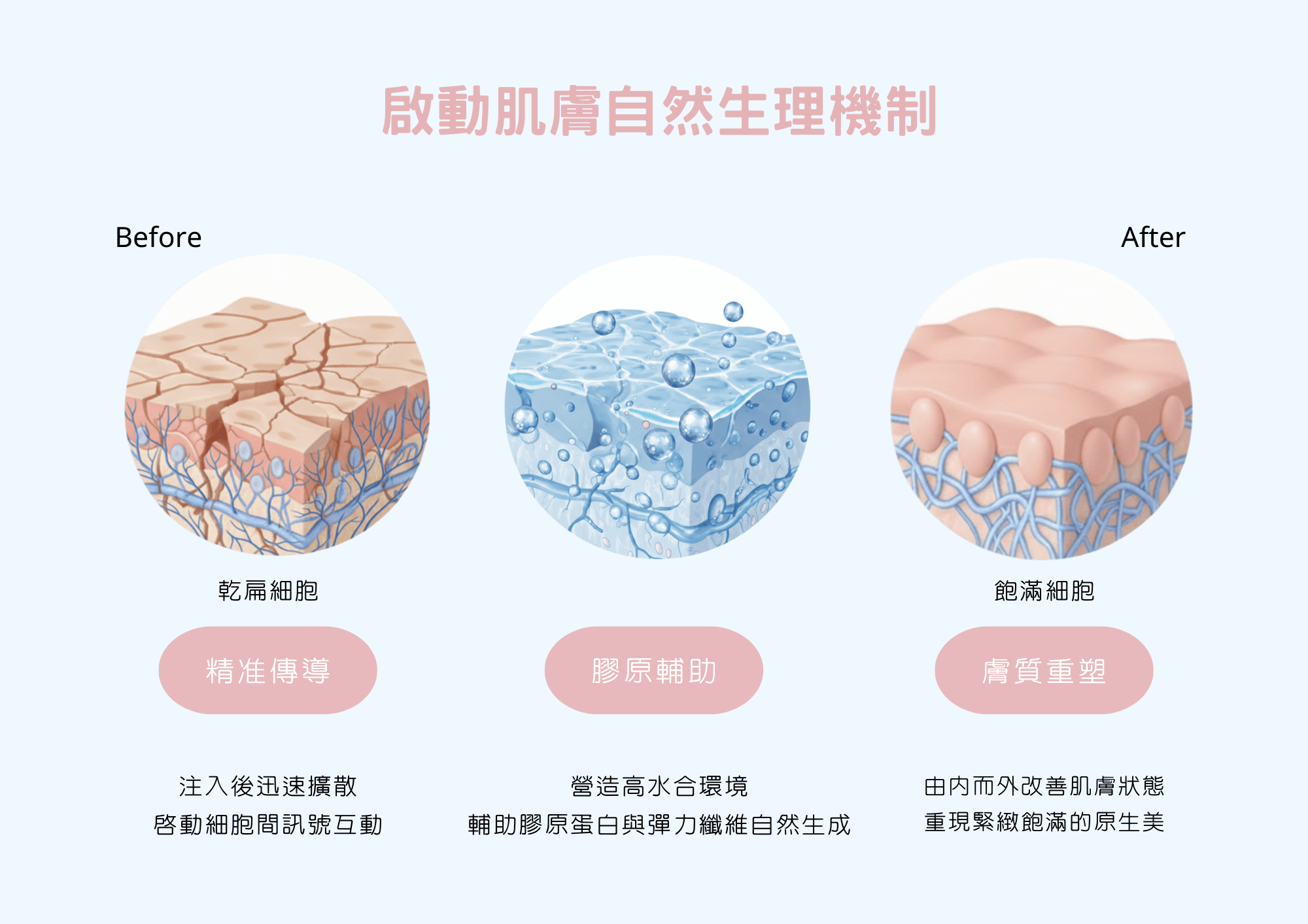 彈力針5